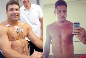 El antes y después de Ronaldo (foto)