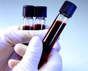 Con tan sólo una muestra de sangre o saliva se podrían detectar algunos tipos de sangre