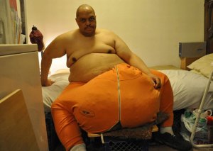 Sus testículos pesaban 60kg y no estaba gozando un “bolón” (Foto)
