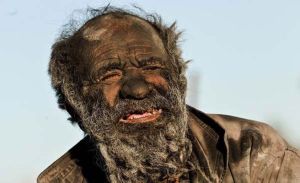 El hombre que lleva 60 años sin bañarse (Foto)