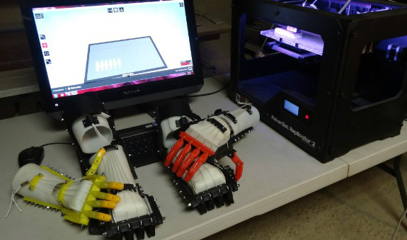 Se amputó los dedos y creó una ‘mano robótica’ con una impresora 3D
