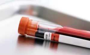 Japón trabaja en simple prueba de sangre para detectar 13 tipos de cáncer