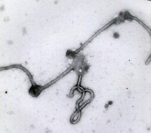 Posible caso de ébola está siendo tratado en  hospital de Miami