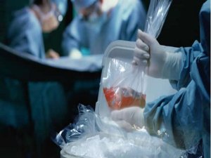 Trasplantar órganos de donantes vivos mejora la sobrevida del receptor