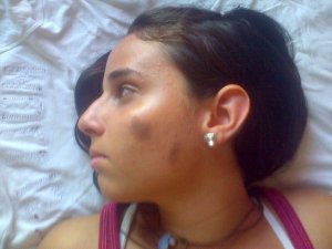 Terror en Cojedes: Joven fue salvajemente golpeada por colectivos durante visita de Lilian Tintori (Fotos)