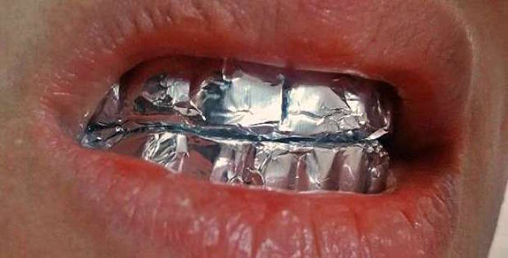¿Cómo blanquear los dientes con papel de aluminio?