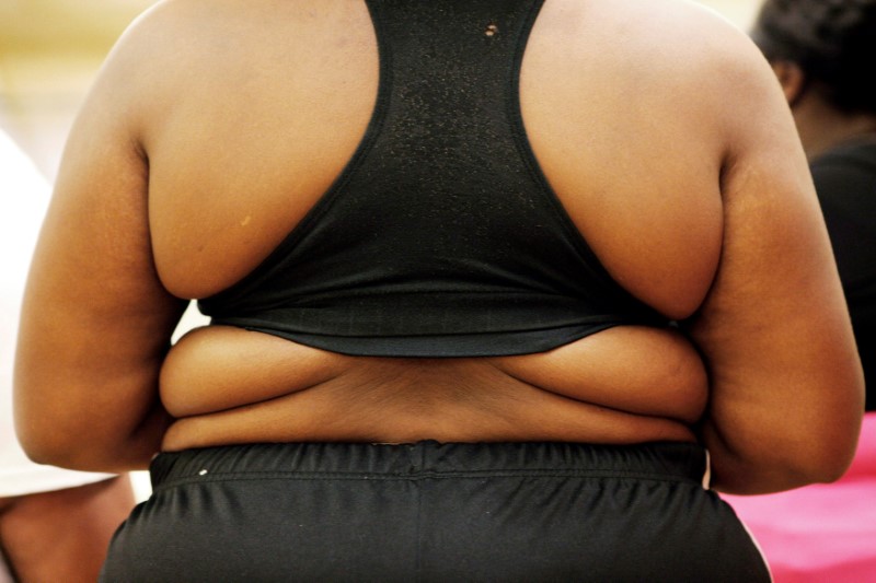 América Latina pasa de luchar contra el hambre a sufrir “epidemia” de sobrepeso, según la FAO
