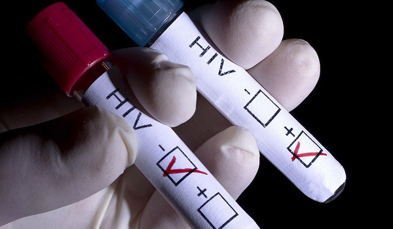 Desaparecidos 20 de los 23 antirretrovirales para personas con VIH