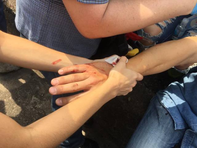 Uno de los heridos por perdigón en la movilización de Táchira. La marcha continúa. Foto: @dcusnir82