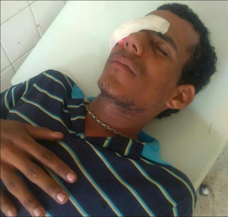 Fuertes enfrentamientos en Carora: Reportan al menos cinco lesionados y dos detenidos