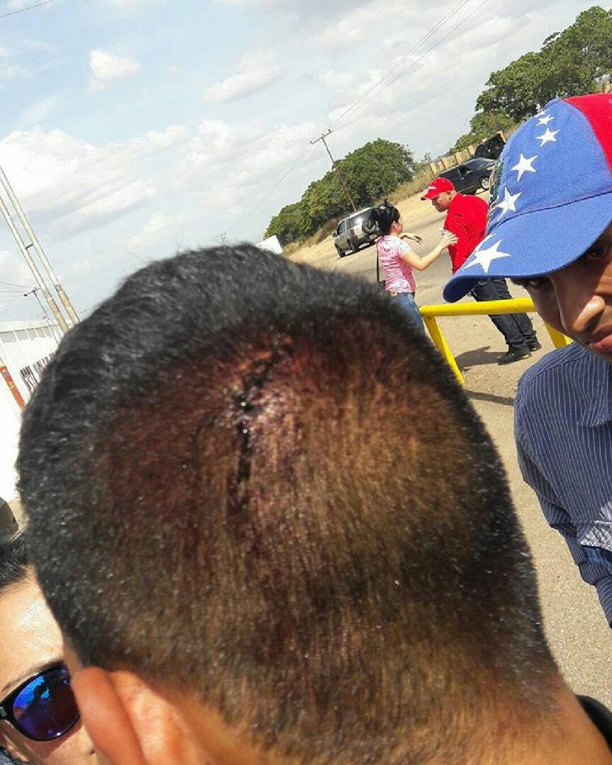 José Brito: Fue aberrante la tortura que vivieron 30 ciudadanos en El Tigre por parte de la GNB