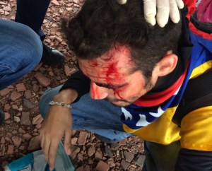 Hieren a joven en la cabeza durante represión en Maracaibo #16Jun (Foto + Videos)