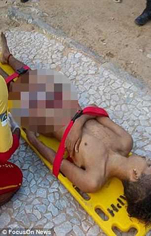 Foto: Muere brasilero luego que un tiburón le arrancara el pene en un horrible ataque / dailymail.co.uk