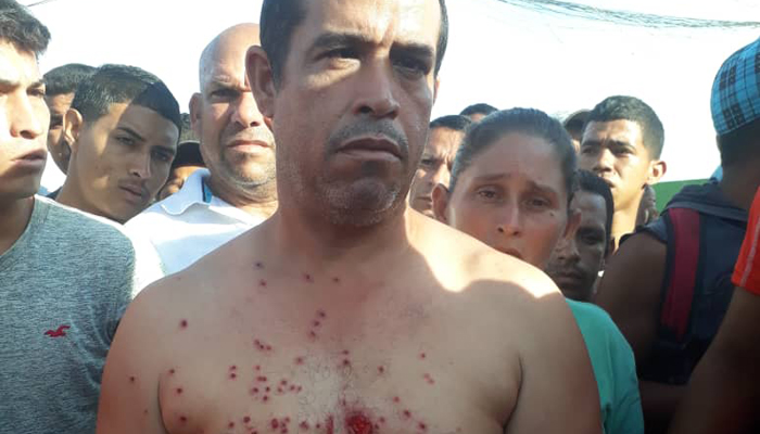 Por negarse a ser reubicados, reprimen violentamente a pescaderos del Mercado de Chirica #9Nov