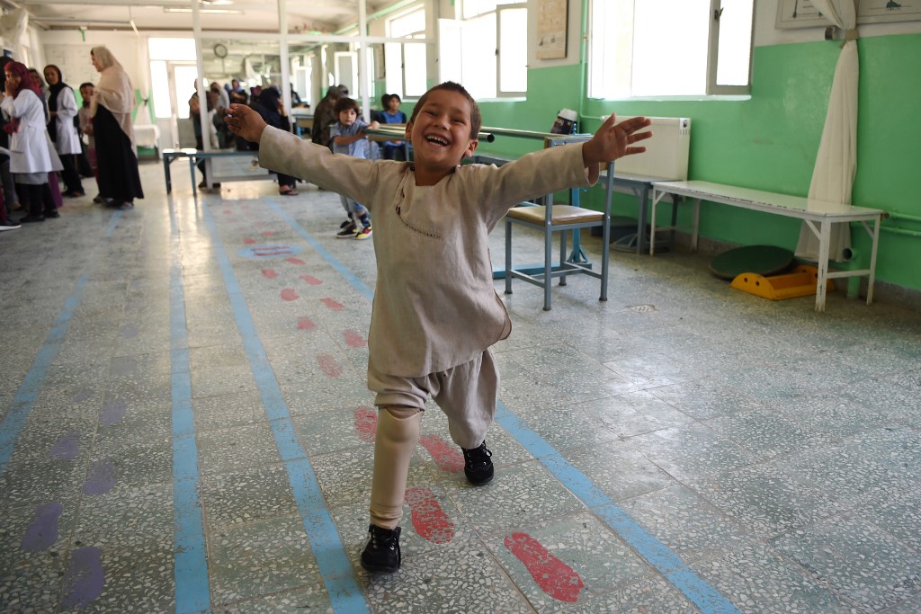 La alegría de un niño amputado que baila con su pierna nueva conmueve a Afganistán (Fotos)