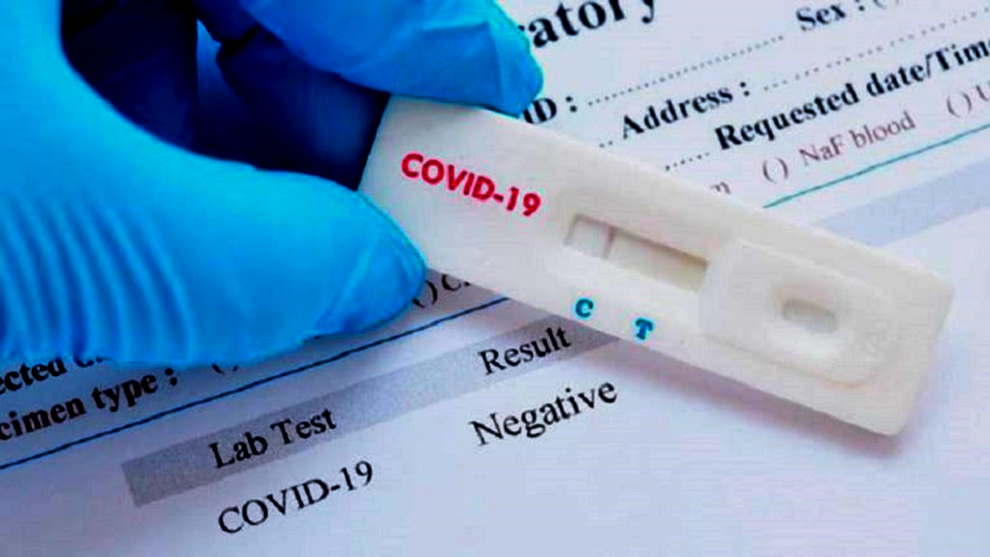 Estados Unidos aprueba nueva prueba de antígeno de coronavirus