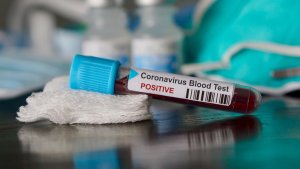 Identificaron en Cataluña los primeros casos de “flurona”, la infección conjunta de Covid-19 y gripe