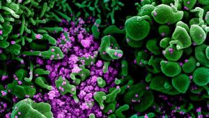 Hallan el factor que hace más contagiosa a la cepa británica de coronavirus: Una mutación de la proteína ‘spike’