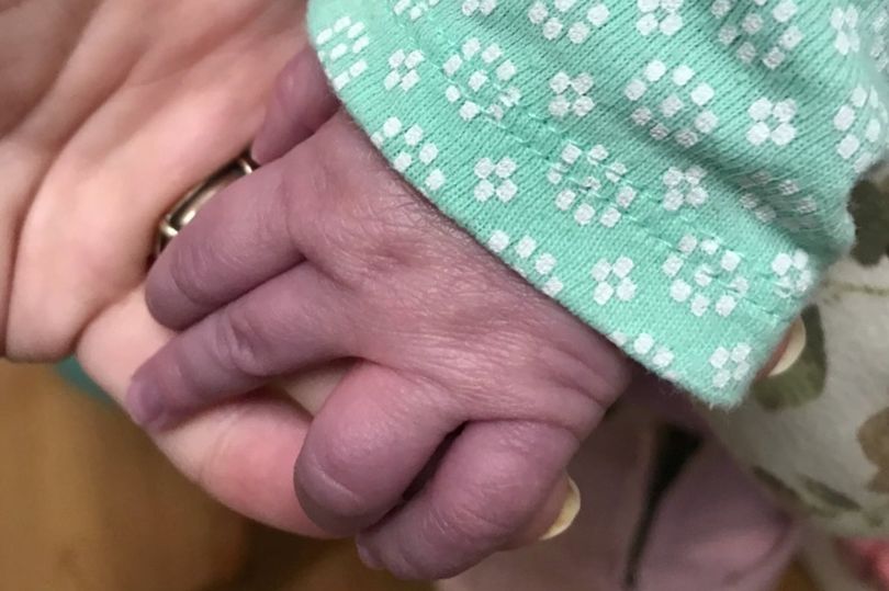 Bebé en Ohio sufrió una extraña complicación del Covid-19 que le dejó las manos y los pies azules