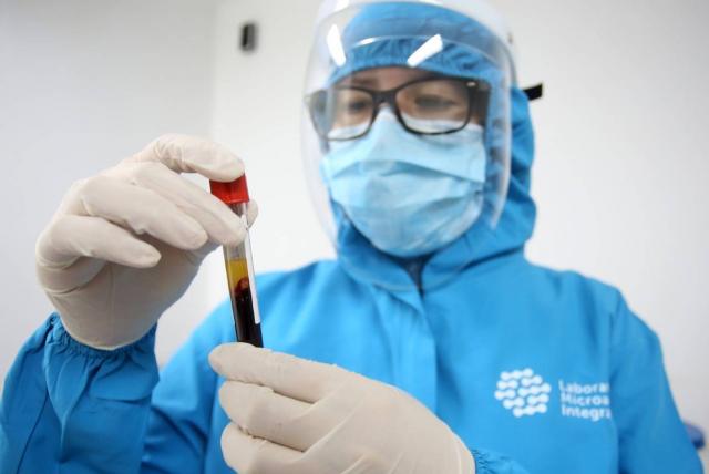 Detectan primer caso de la variante brasileña del coronavirus en Bogotá
