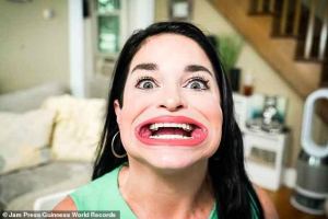 Estadounidense consiguió el récord Guinness por tener la boca más grande del mundo