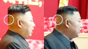 Mancha verdosa en la cabeza de Kim Jong Un alimenta especulaciones sobre su salud
