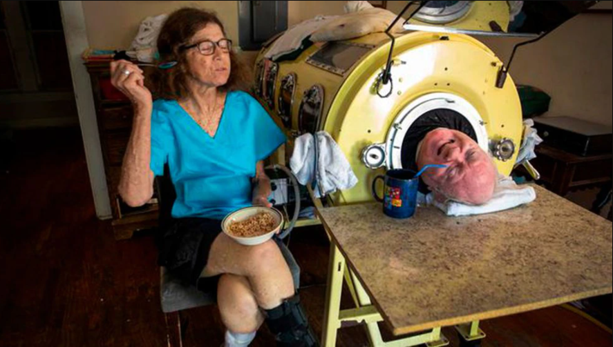 “El hombre en el pulmón de acero”: Contrajo polio y vive dentro de un cilindro desde hace 70 años (FOTOS)