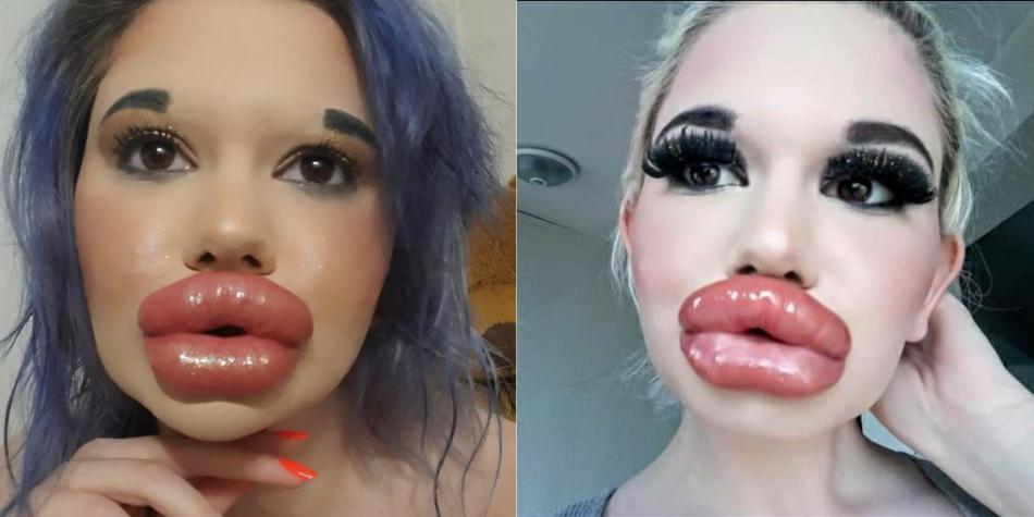 La mujer con los labios más grandes del mundo que quiere parecer una Barbie (FOTOS)