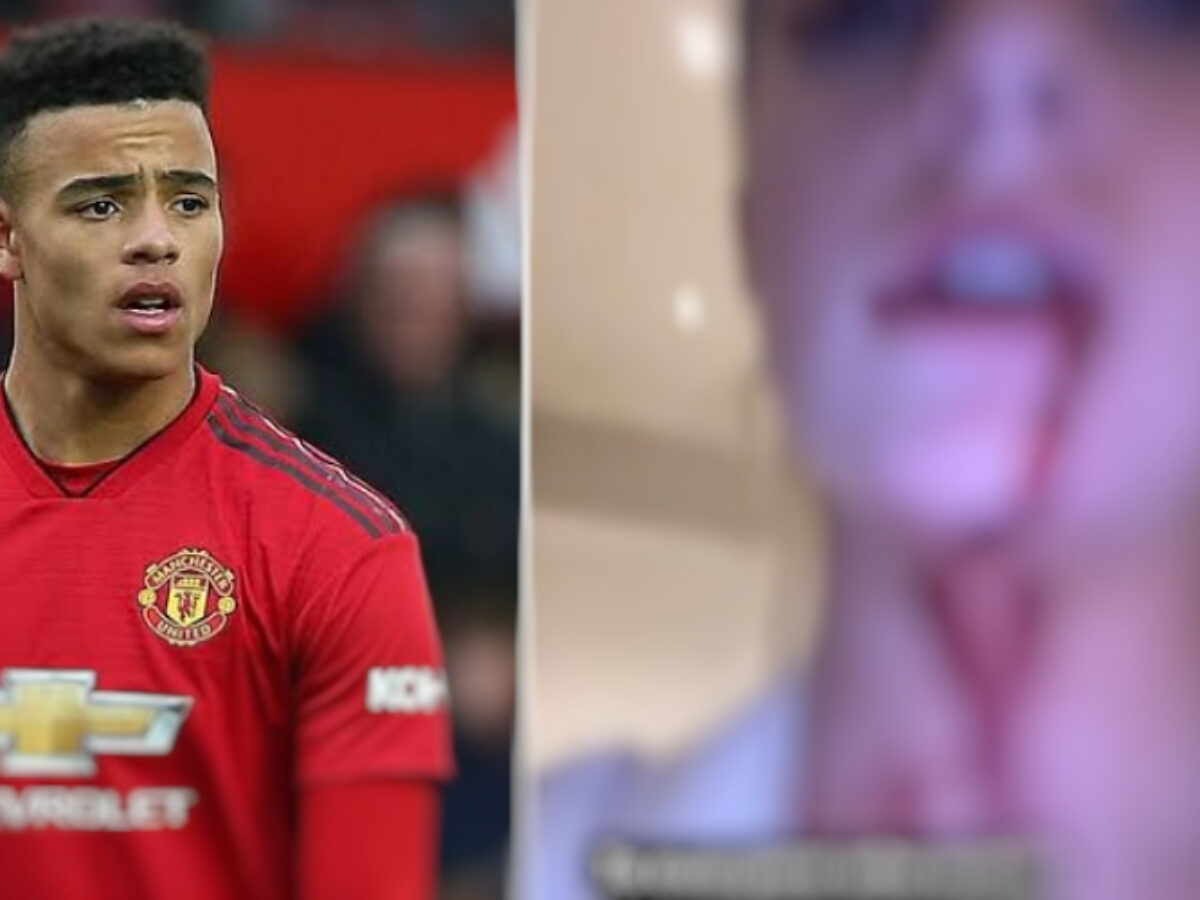 Imágenes sensibles: Así quedó la cara de la novia de un jugador del Manchester United tras brutal paliza