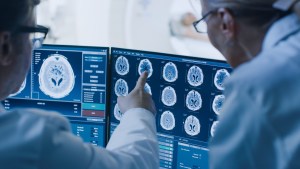 Crean una novedosa técnica para el estudio de fármacos especializados en la metástasis cerebral