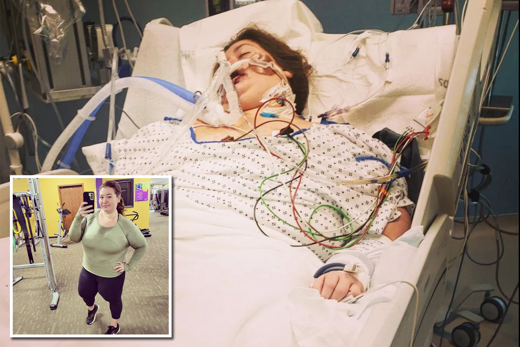 Se convirtió en influencer tras perder 140 kilos, ahora está hospitalizada por fallas de órganos