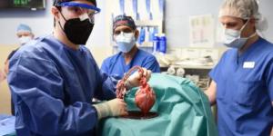 Trasplantan con éxito corazones de cerdo modificados a dos personas con muerte cerebral