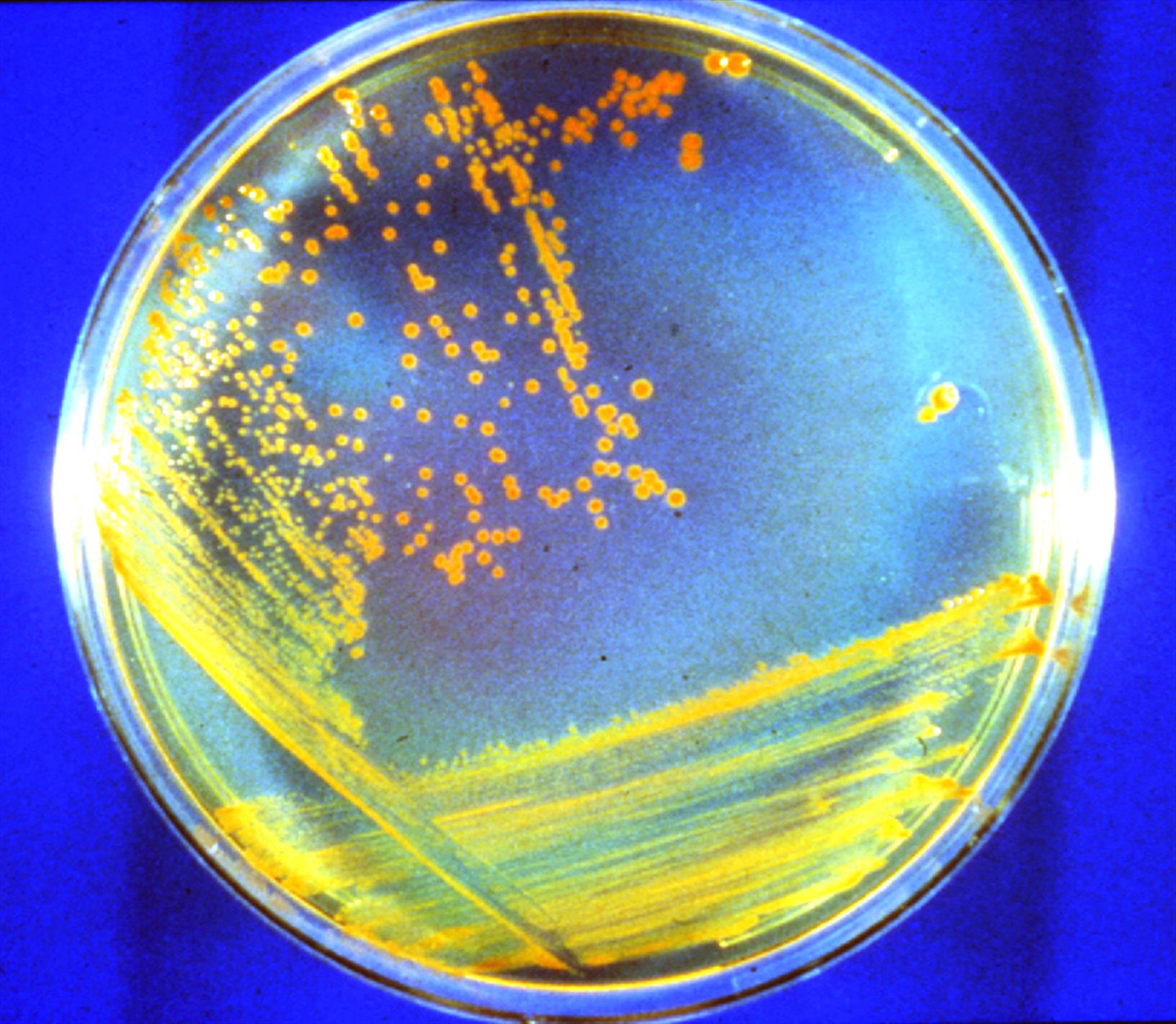 Antiguas bacterias de Marte podrían sobrevivir cerca de la superficie del planeta